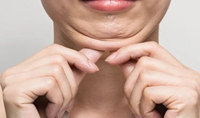 Keşanlı 3 dermatolog, Tiflis'teki Dermavizyon toplantısında buluştu