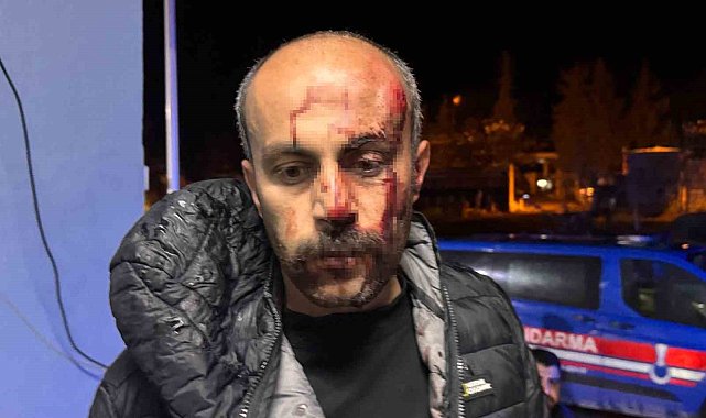Şanlıurfa'da müvekkilinin yanına giden avukata darp iddiası