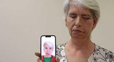 Sol gözünü 41 yıl sonra 24 ayar altınla yapılan tedavi sonucu kapattı