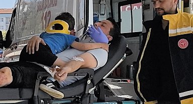 Kazada yaralanan çocuğu eldivenden yaptıkları balonla oyaladılar