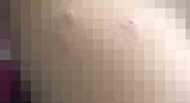 Sokak köpeği 5 yaşındaki çocuğa saldırdı