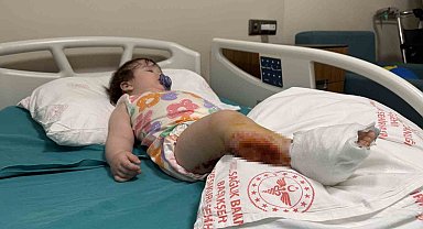 Üzerine çaydanlık devrilen 1 yaşındaki bebek dehşeti yaşadı, vücudunun yüzde 15'i yandı