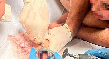 Bursa'da çocuğun parmağı çeşme aynasına sıkıştı