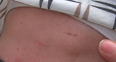 Çamaşırlarının üstüne çöp döktüğü komşusunu önce dövdü sonra darp raporu aldı