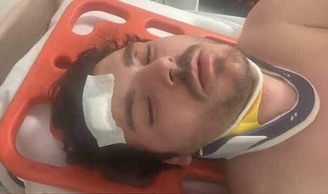 Darp edilen oyuncu dehşet anlarını anlattı: "Ölecektim"