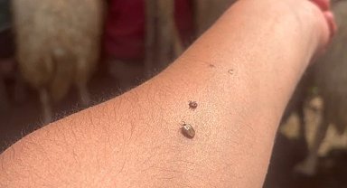 Erzincan'da KKKA uyarısı: Kene temasına karşı dikkatli olun!