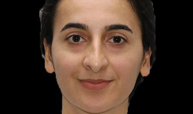 Erzurum'da tedavi gören polis memuru Burcu Ertem vefat etti