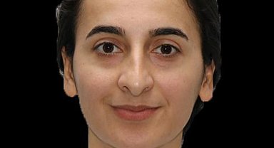 Erzurum'da tedavi gören polis memuru Burcu Ertem vefat etti