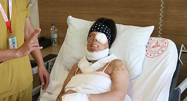 Genç kadının hayatı kezzapla karardı