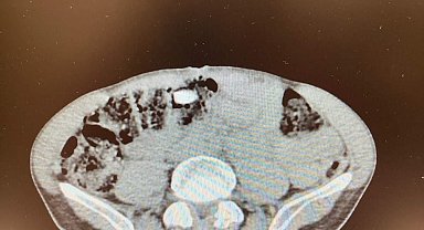 Havayoluyla Denizli'ye gelen yabancı yolcu 1,25 kilo uyuşturucu ile yakalandı