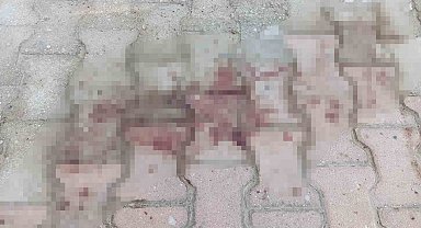 Komşusunun balkonundan kendi evine geçmeye çalışırken düşen kadın ağır yaralandı