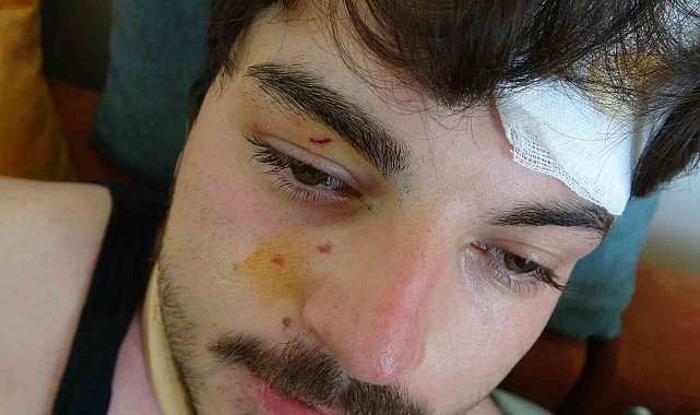 Trafikte darbedilen oyuncu Mehmet Akif Akdeniz yaşadığı dehşeti anlattı