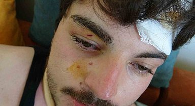 Trafikte darbedilen oyuncu Mehmet Akif Akdeniz yaşadığı dehşeti anlattı