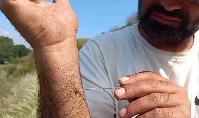 Uzmanı uyardı: "Kenenin vücutta kalma süresi hastalığın bulaşma riskini yükseltiyor"
