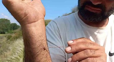 Uzmanı uyardı: "Kenenin vücutta kalma süresi hastalığın bulaşma riskini yükseltiyor"