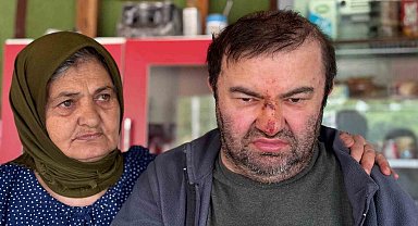 Yüzde 90 engelli vatandaş acımasızca darp edildi