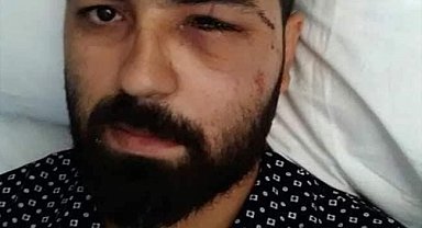 15 Temmuz Gazisi Akkoç: "Darbeci asker dalga geçer bir ses tonu ile 'sen kelime-i şehadet getir' dedi"