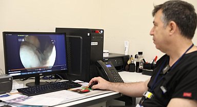 Dev mide tümörü cerrahi müdahaleye gerek kalmadan endoskopik yöntemle çıkarıldı