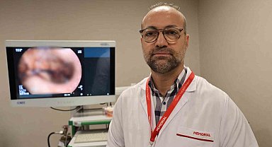 Mide küçültme tercihinde yeni yöntem ameliyatsız endoskopik tüp mide işlemi