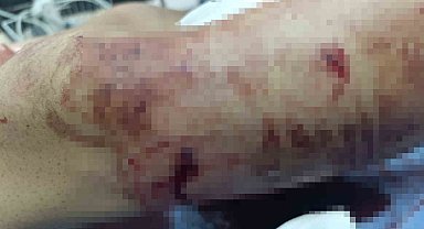 Muş'ta ayının saldırdığı çocuk yaralandı