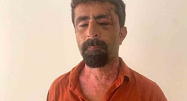 Antalya'da öfkeli damat kayınpederini hastanelik etti