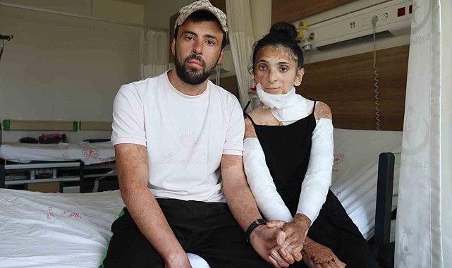 Azerbaycanlı çiftin doğal gaz patlamasında kapanan elleri, 3 yıl sonunda Eskişehir'deki tedaviyle kavuştu