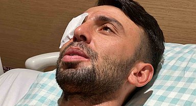 Balkondan açılan ateşte gözünden yaralanan işçi: "Sağ gözümden oldum"
