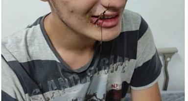 Bu kez oltaya çocuk takıldı