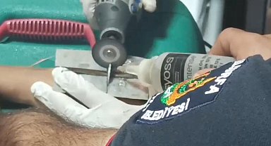 Çocuğun parmağına sıkıştırdığı cıvata pulu kesilerek çıkartıldı