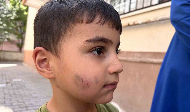 Evde uyuyan çocuğu lağım faresi ısırdı