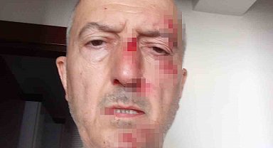 Önce icra yoluyla evinden tahliye edildi, ardından darp edildi