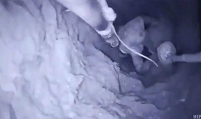 Suriye'de kuyuya düşen çocuk kurtarılarak tedavi için Şanlıurfa'ya getirildi