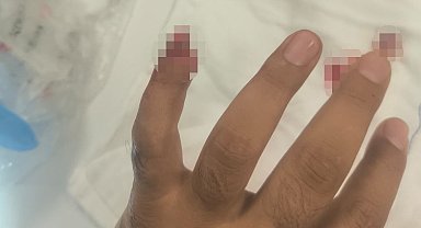 Uyuşturucuyla yakalanan şüpheli, polisin parmağını kopardı