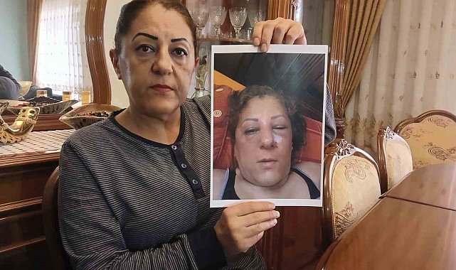 Apartman bahçesinde beslediği kediler nedeniyle komşuları tarafından darbedilen kadının burnu kırıldı