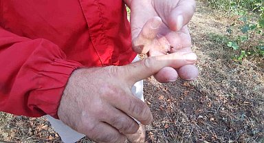 Ayının saldırısına uğrayan çiftçi dehşet anlarını anlattı: "Parmağımı kopardı"