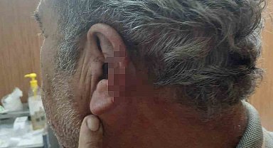 Doktor ile emekli öğretmenin mesai kavgası karakolda bitti
