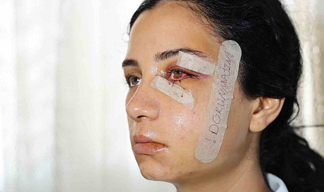 Eski eşini dövüp serbest kalan şüpheli tutuklandı