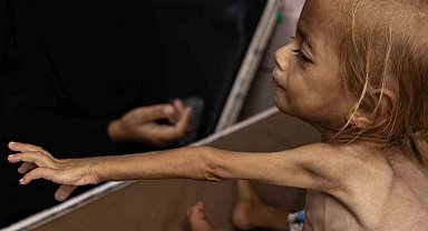 Gazze'de 24 saat içinde 5 sivil açlık nedeniyle hayatını kaybetti