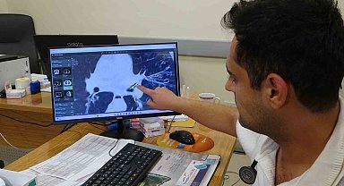 Kansersin, astımsın dediler: Akciğerinden kabak çekirdeği çıktı