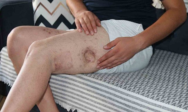 Kendisine iyilik yapmaya çalışan akrabasını önce vurdu, sonra da icra davası açtı