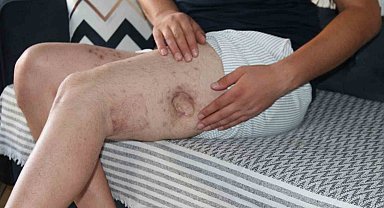 Kendisine iyilik yapmaya çalışan akrabasını önce vurdu, sonra da icra davası açtı