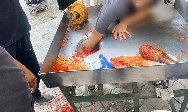 Kız çocuğu elini salça makinesine kaptırdı