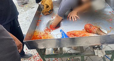 Kız çocuğu elini salça makinesine kaptırdı