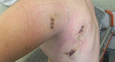 Kız kardeşini korumak isterken 5 yerinden bıçaklanmıştı: O anları anlattı: "Ölümden döndüm"