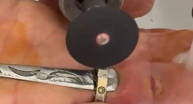 Parmağına yüzük sıkışan kadının yardımına itfaiye yetişti