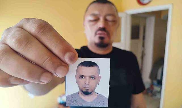 Saçlarını siyahlatmak için aldığı şampuan arı sokmasından beter hale getirdi