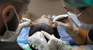 Sağlık Bakanlığı'ndan saç ekimi birimlerinde yeni dönem