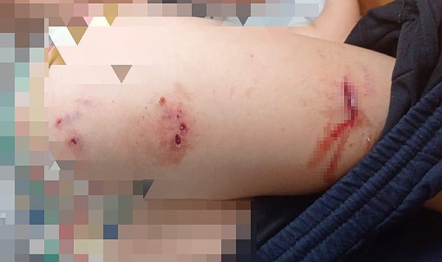 Sokak köpekleri faciaya neden oluyordu: Komşular yetişmeseydi parçalayacaklardı