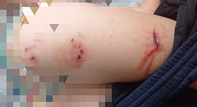 Sokak köpekleri faciaya neden oluyordu: Komşular yetişmeseydi parçalayacaklardı