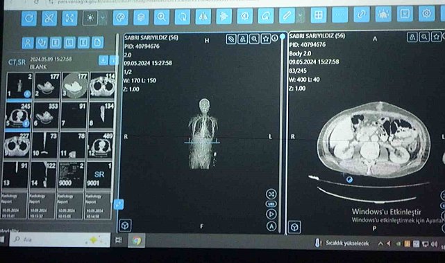 Van'dan dünyaya örnek çalışma: Kanser tedavisinde yapay zekâ kullanıldı